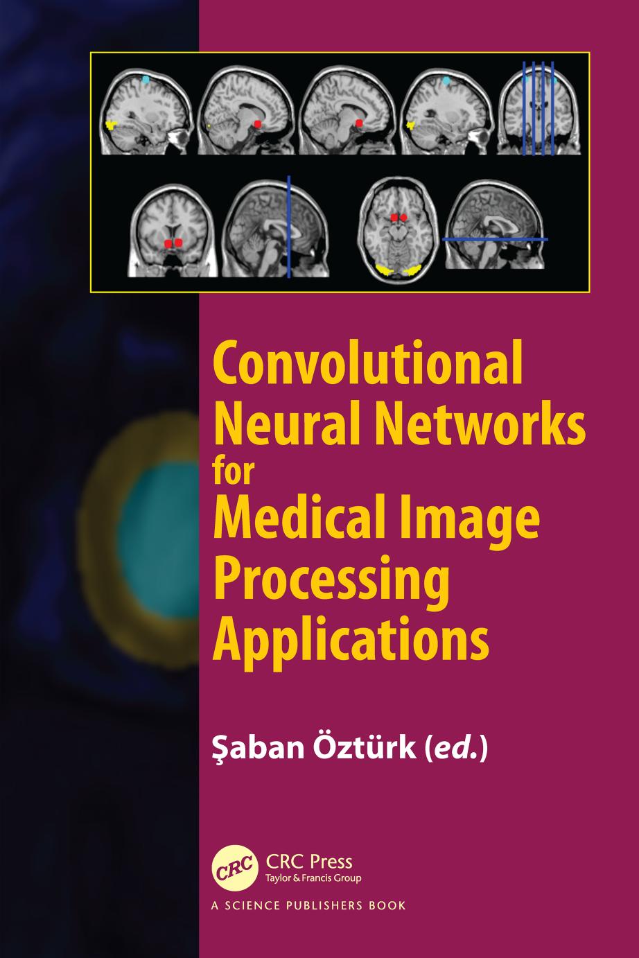 Convolutional Neural Networks for Medical Image Processing Applications